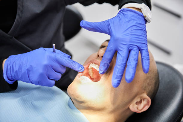 Best Same-Day Emergency Dental Services in Sylva, NC